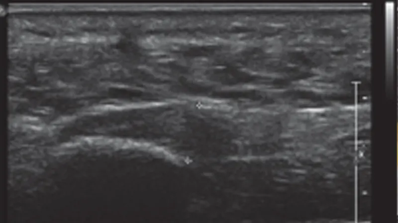 Ultrasound of the feet